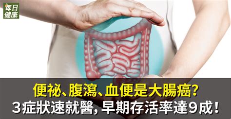 便祕、腹瀉、血便是大腸癌？3症狀速就醫，早期存活率達9成！ 健康 Nownews今日新聞