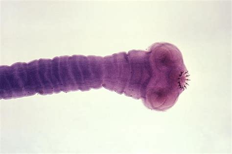 A Man's Eye Floater Was Actually a Tapeworm — Plus Thousands of Its Eggs | Live Science