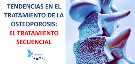 Tendencias En El Tratamiento De La Osteoporosis La Terapia Secuencial