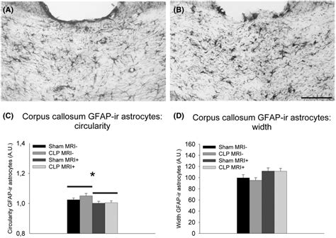 Photomicrographs Illustrating GFAPir Astrocytes In The Corpus Callosum