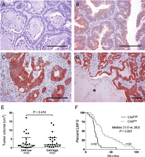 Negative A Moderate B And Intense C Ca9 Staining Of Download Scientific Diagram