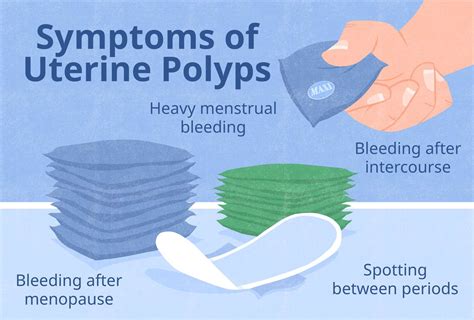 Uterine Polyps Endometrial Polyp Causes Symptoms Mayo Clinic Q And A: