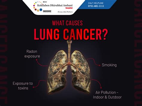 What causes lung cancer?