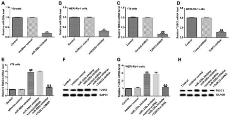 Expression Of MiR 320a And TUSC3 In Transfected Cells Y79 And