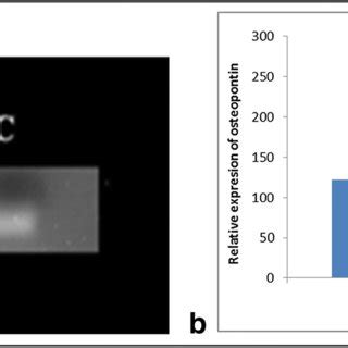 Comparison Of Osteopontin Mrna Expression In Dpscs Among L L And