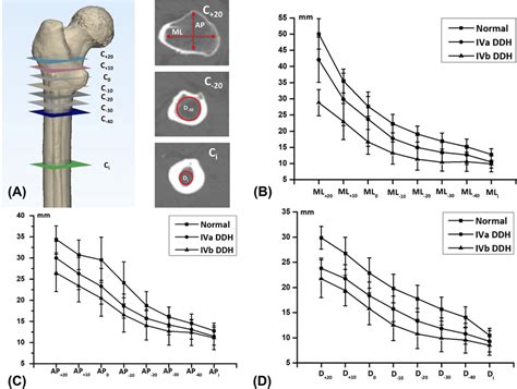 Measurements Of Medullary Canal Dimensional Parameters A Definition Of