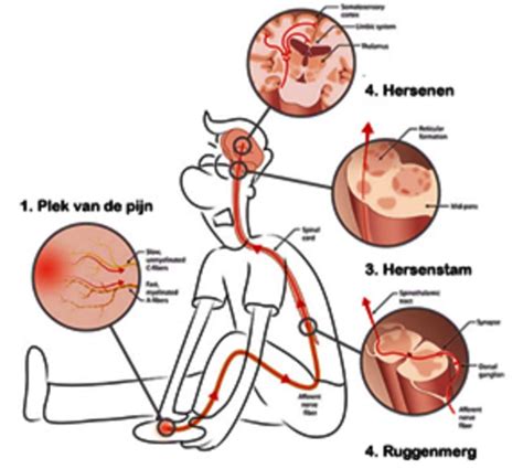Fysiologie Van Pijn Juf Danielle