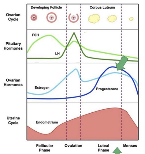 Hormonal Headaches Menstrual Migraine