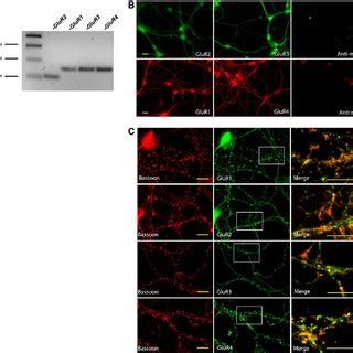 Confocal Immunohistochemistry For Ampar Subunits Expressed In The