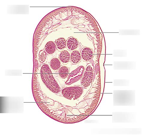 Ascaris Lumbricoides Male And Female Cross Section