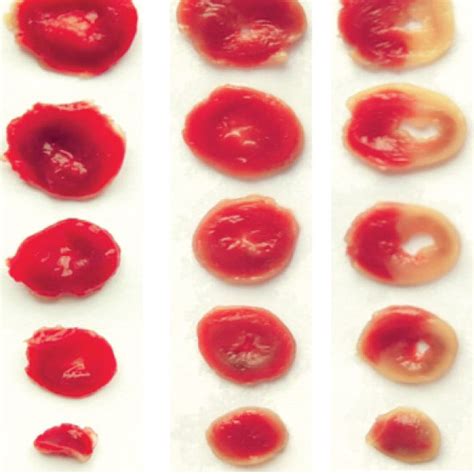 I R Injury Contribute To Myocardial Infarction And Apoptosis A Ttc