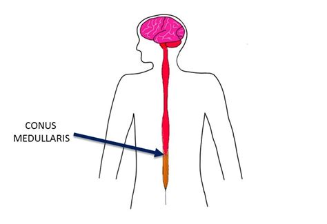 Conus medullaris - definition — Neuroscientifically Challenged