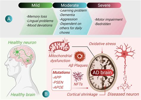 Nanomaterials In Alzheimers Disease Treatment A Comprehensive Review