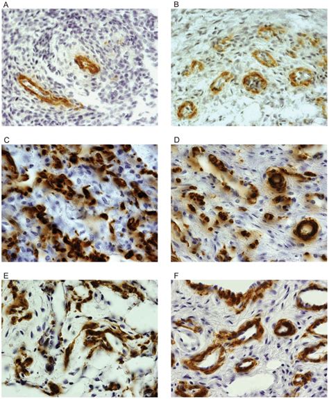 Photomicrographs Of Smooth Muscle Fibers In The Corpus Cavernosum And