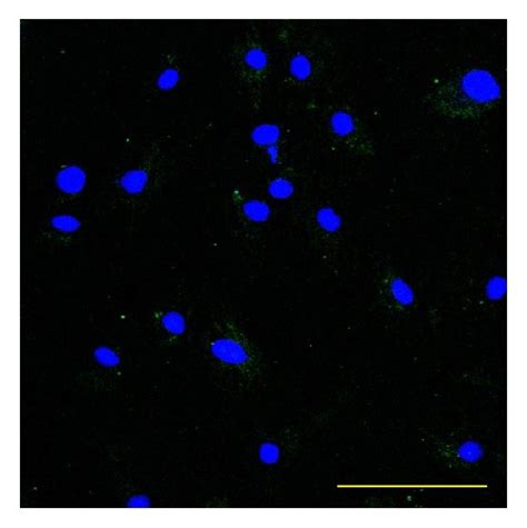 Immunofluorescence Staining Of Cd45 Immunofluorescence Staining Of