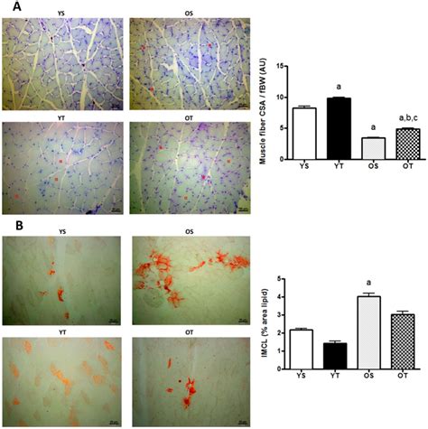 Resistance Training Regulates Gene Expression Of Molecules Associated