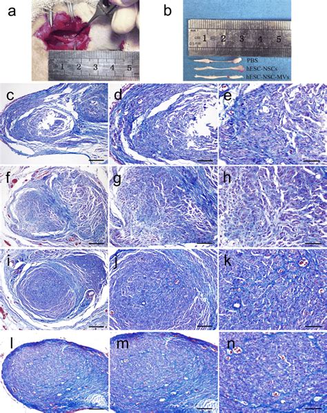 Regenerated Nerve After Repair Of A Sciatic Nerve Defect At Weeks A