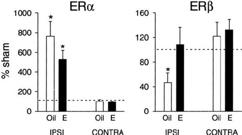 Estrogen Receptor Alpha Er And Estrogen Receptor Beta Er Gene