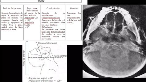 PROYECCIONES RADIOGRÁFICAS DE CRANEO PPT