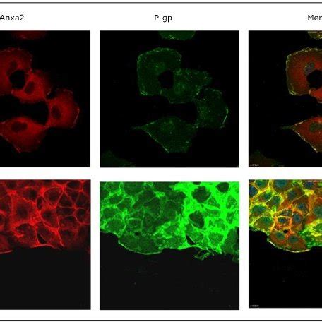 Co Localization Of Anxa2 And P Gp In MCF 7 ADR Cells A Confocal