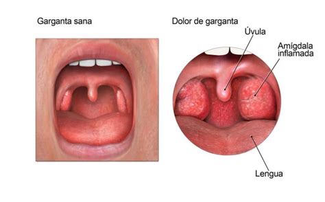 Am Gdalas Grandes Causas S Ntomas Tratamientos Consecuencias Y M S