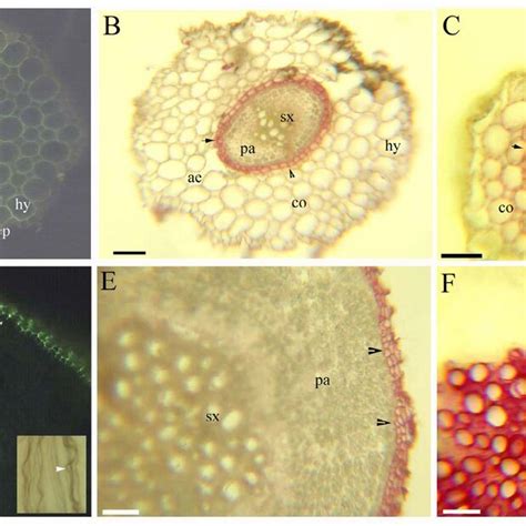 Af Photomicrographs Of The Secondary Structure Of Mature C