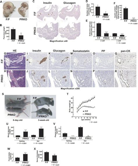 Notch Rbp J Signaling Prevents Premature Endocrine And Ductal Cell