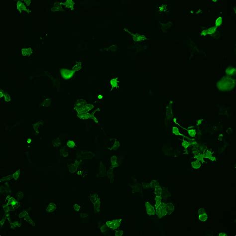 Human Fgfr4 Cdna Clones Hg10538 Sino Biological