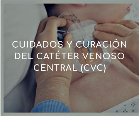 Cuidados Y Curaci N Del Cat Ter Venoso Central Cvc Medidas De