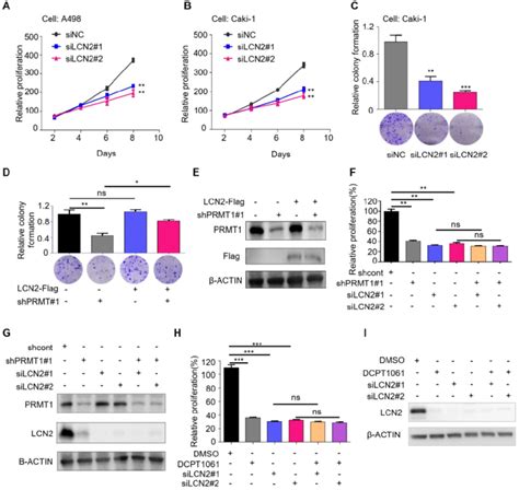 LCN2 Is A Functional Mediator Of PRMT1 In CcRCC Cells A B SRB Assays