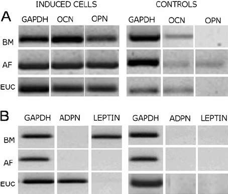 Rt Pcr Analysis Of Differentiated Mscs A Rt Pcr Analysis Of