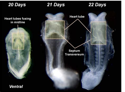 Intermediate Primordial Heart Tube Embryology