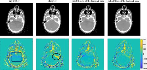 Synthetic CT Generation From CBCT Images Via Deep Learning Chen