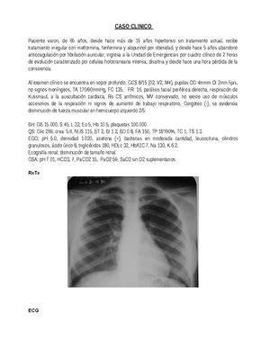 Historia Clinica Neurologia EST CONDORI NINA JOSE BRAYAN FECHA 25