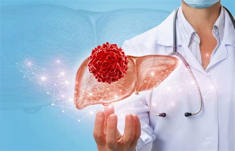 Liver Cancer Hepatoma Important Things To Know About Liver Cancer