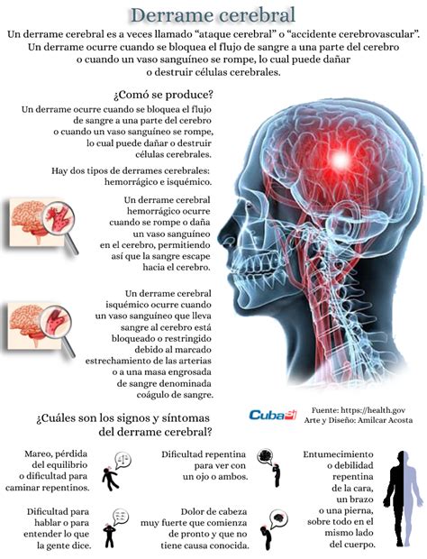 C Mo Detectar Que Alguien Sufre Un Posible Derrame Cerebral Infograf A