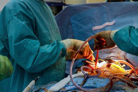 Cardiothoracic Surgery Vs General Surgery In Balaghat