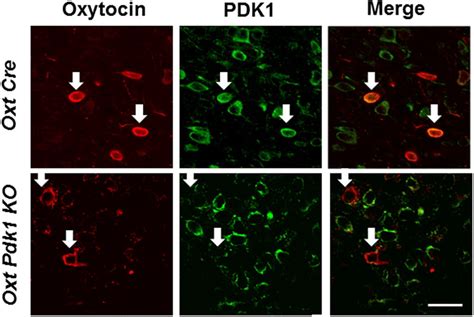 Double Immunostaining For Oxytocin And Pdk1 In Pvn Of Oxy Cre And Oxy Download Scientific