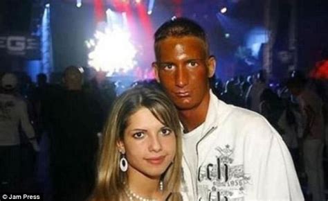 Funny pictures show the most epic tan fails from sunbeds | Daily Mail Online