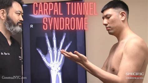 Avoid Surgery For Carpal Tunnel Syndrome Specific Chiropractic Nyc