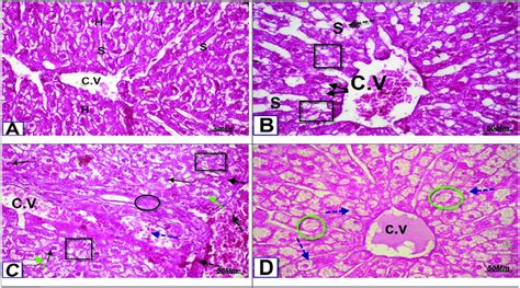 A Photomicrograph Of Ts In The Liver Of Control Rat Showing Normal Download Scientific