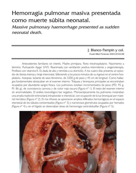 Aspecto Macroscópico De Los Pulmones Download Scientific Diagram