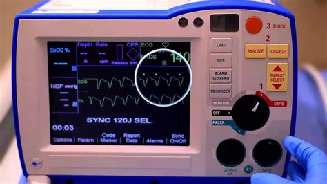 Zoll R Series Als Defibrillator Monitor With Pacing 54 Off