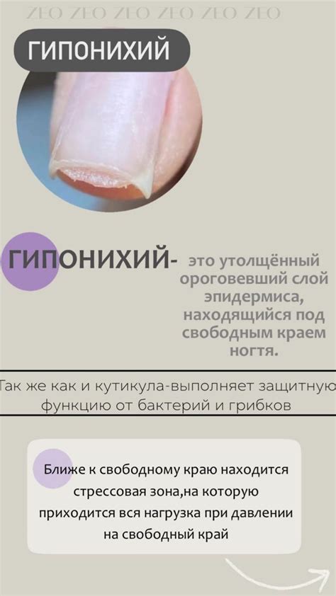 Маникюр. Гипонихий | Маникюр, Здоровые ногти, Базовые ногти in 2022 ...