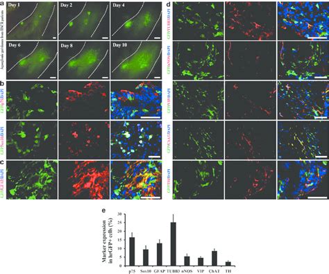 Human Induced Pluripotent Stem Cell Derived Neural Crest Stem Cells