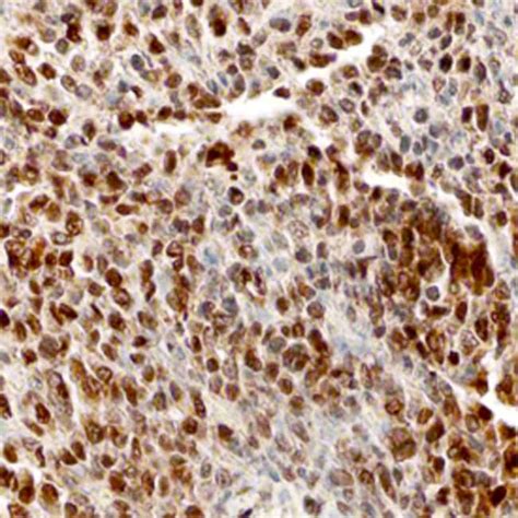 Human BACH1 Antibody R D Systems 100μg Unlabeled Antibodies