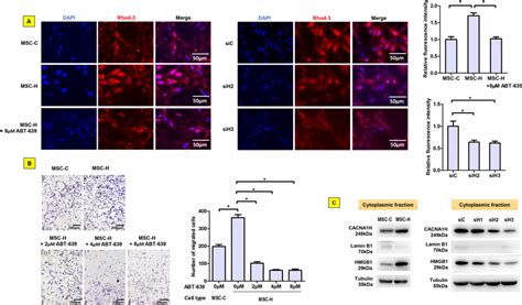 Contribution Of Cav T Type Calcium Channel To Msc H Cell Migration