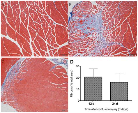 Expression And Role Of Lncrnas In The Regeneration Of Skeletal Muscle