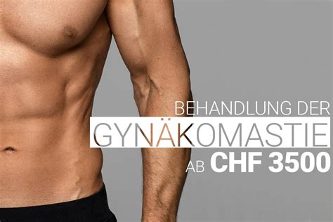 Gynäkomastie Behandlung M1 Med Beauty Zürich