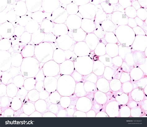 Adipose Cell: Over 789 Royalty-Free Licensable Stock Photos | Shutterstock